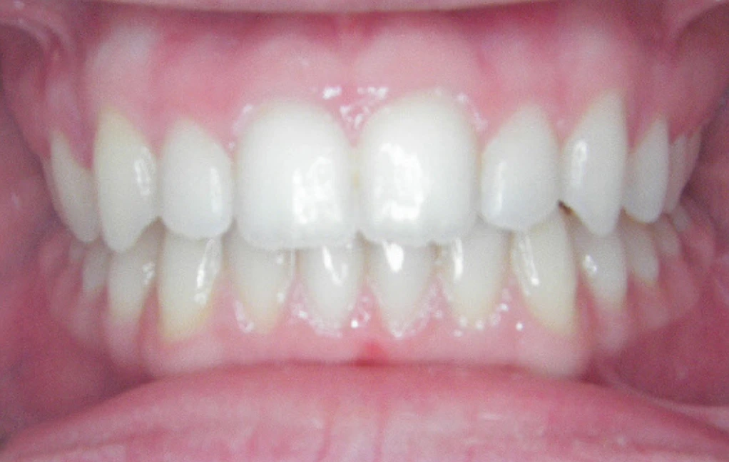 second image